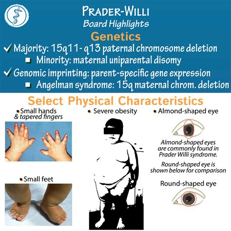 willie prada|willie prada syndrome.